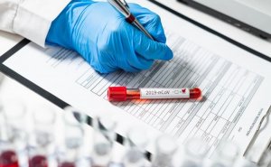 Azərbaycanda koronavirusla bağlı SON DURUM