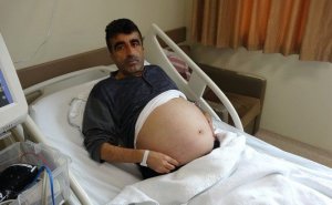 Kökəlib deyə 2 il PƏHRİZ ETDİ - Başına elə şey gəldi ki...
