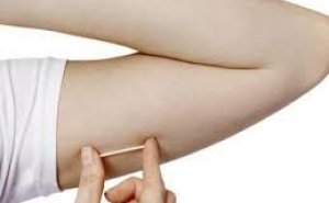 Hamiləlikdən qoruyan implant – diqqətsizlik həyati risk yarada bilər! video/