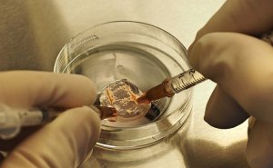 Tese və mikrotese nədir? video/