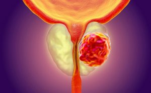 Prostat və cinsi həyat: Nəyi bilməlisiniz? ANDROLOQDAN AÇIQLAMA video/