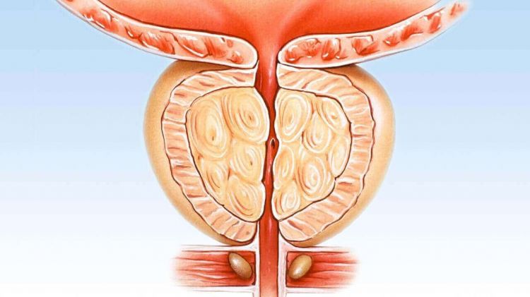 Sidikdə yanma, ağrı, narahatlıq – prostat xəbərdarlığı ola bilər? video/