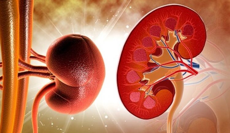 Hidronefroz – uşaqlarda ən çox rast gəlinən böyrək problemi video/